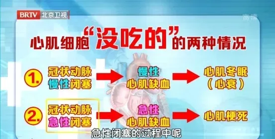 心脏的“防老剂”被发现!就藏在炖肉料包中,能修复心肌、让心跳更有力~ 心脏的“防老剂”被发现!就藏在炖肉料包中,能修复心肌、让心跳更有力~