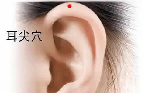 耳尖一滴血，四两拨千斤！老祖宗的极简中医疗法：退热、消炎、降压、止痛……全管用