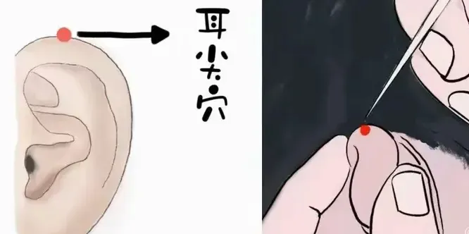 耳尖一滴血，四两拨千斤！老祖宗的极简中医疗法：退热、消炎、降压、止痛……全管用